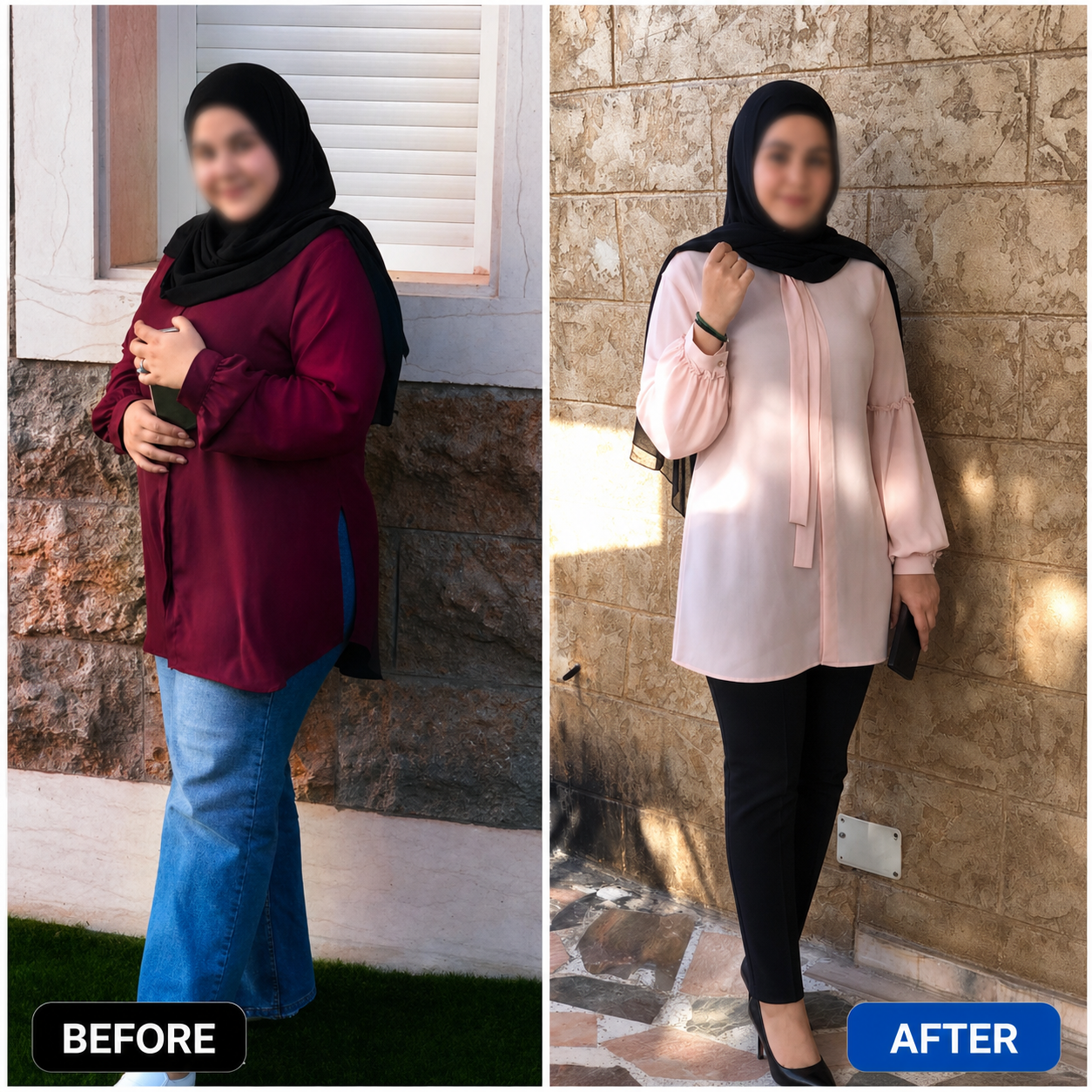 Rim transformation after losing 9 kilograms